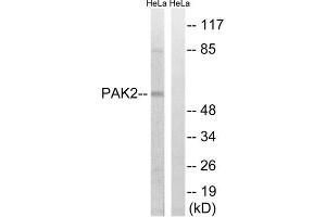 Western blot analysis of extracts from HeLa cells, treated with TSA (400nM, 24hours), using PAK2 (epitope around residue 141) antibody. (PAK2 antibody  (Ser141))