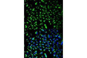 Immunofluorescence analysis of HeLa cell using PHB antibody. (Prohibitin antibody  (AA 73-272))