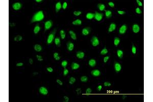 Immunofluorescence of monoclonal antibody to HELZ on HeLa cell. (HELZ antibody  (AA 1-100))