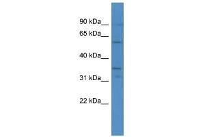 WB Suggested Anti-CA5A Antibody Titration: 0. (CA5A antibody  (C-Term))
