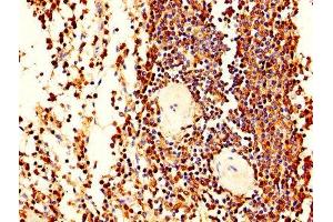 IHC image of ABIN7163556 diluted at 1:400 and staining in paraffin-embedded human spleen tissue performed on a Leica BondTM system. (LCP1 antibody  (AA 2-627))