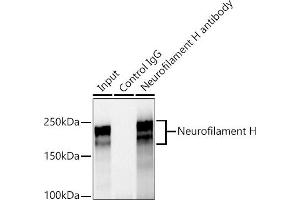 Immunoprecipitation analysis of 600 μg extracts of Rat brain cells using 3 μg Neurofilament H antibody (ABIN7268866).