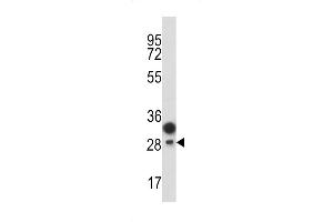 Western blot analysis of CD201 antibody in T47D cell line lysates (35ug/lane) (PROCR antibody  (AA 104-132))