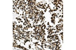 IHC analysis of USP44 using anti-USP44 antibody (ABIN7600640).
