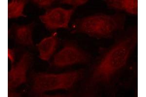 Immunofluorescence staining of methanol-fixed Hela cells using p56Dok-2(Phospho-Tyr299) Antibody. (DOK2 antibody  (pTyr299))