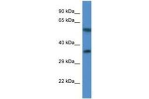 Image no. 1 for anti-Mitochondrial Ribosomal Protein L45 (MRPL45) (C-Term) antibody (ABIN6746836) (MRPL45 antibody  (C-Term))
