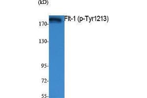 Western Blotting (WB) image for anti-Fms-Related tyrosine Kinase 1 (VEGFR1) (FLT1) (pTyr1213) antibody (ABIN3179854) (FLT1 antibody  (pTyr1213))