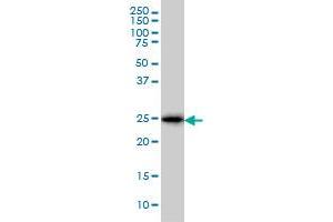 CD99 monoclonal antibody (M01), clone 3A10 Western Blot analysis of CD99 expression in K-562 . (CD99 antibody  (AA 23-122))