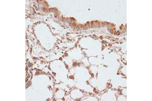 Immunohistochemistry of paraffin-embedded mouse lung using Phospho-VASP-S157 antibody (ABIN6135335, ABIN6136286, ABIN6136287 and ABIN6225657) at dilution of 1:100 (40x lens). (VASP antibody  (pSer157))