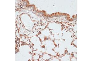 Immunohistochemistry of paraffin-embedded mouse lung using Phospho-VASP-S157 antibody (ABIN6135335, ABIN6136286, ABIN6136287 and ABIN6225657) at dilution of 1:100 (40x lens).