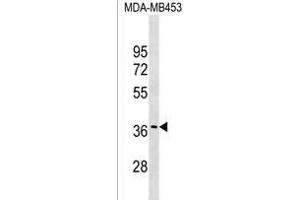 GJC3 Antibody (C-term) (ABIN1536946 and ABIN2849303) western blot analysis in MDA-M cell line lysates (35 μg/lane). (GJC3 antibody  (C-Term))