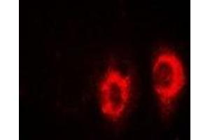 Immunofluorescent analysis of UBE2H staining in SW480 cells. (UBE2H antibody)