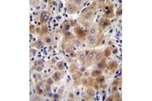 Immunohistochemistry analysis in formalin fixed and paraffin embedded human liver tissue reacted with NEU2 Antibody (N-term) followed which was peroxidase conjugated to the secondary antibody and followed by DAB staining.