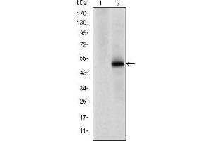 Western blot analysis using CDK9 mAb against HEK293 (1) and CDK9(AA: 178-369)-hIgGFc transfected HEK293 (2) cell lysate. (CDK9 antibody)