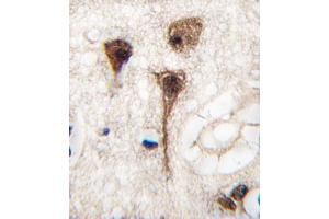 Formalin-fixed and paraffin-embedded human brain tissue reacted with MEF2C Antibody , which was peroxidase-conjugated to the secondary antibody, followed by DAB staining. (MEF2C antibody  (AA 278-307))