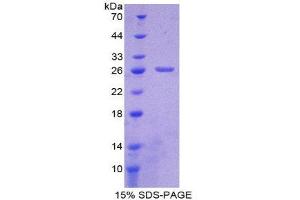 SDS-PAGE (SDS) image for Growth Associated Protein 43 (GAP43) (AA 8-228) protein (His tag) (ABIN2125086)