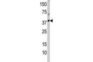 Image no. 1 for anti-RNA Terminal Phosphate Cyclase-Like 1 (RCL1) (N-Term) antibody (ABIN357285) (RCL1 antibody  (N-Term))