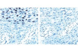 Immunohistochemistry (IHC) image for anti-L1 Protein antibody (ABIN967423) (L1 Protein antibody)