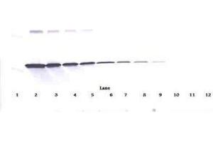Image no. 2 for anti-Interferon gamma (IFNG) antibody (ABIN465161) (Interferon gamma antibody)