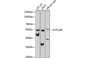 Western blot analysis of extracts of various cell lines, using CYP11B1 antibody (ABIN6130956, ABIN6139312, ABIN6139313 and ABIN6223585) at 1:1000 dilution. (CYP11B1 antibody  (AA 234-503))