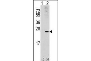 Western blot analysis of RAC1 (arrow) using rabbit polyclonal RAC1 Antibody (S71) (ABIN391836 and ABIN2841676). (RAC1 antibody  (AA 49-78))