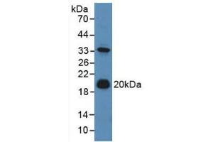 Western blot analysis of Mouse Liver Tissue. (Adrenomedullin antibody  (AA 24-171))