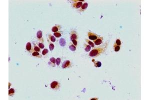 Immunocytochemistry analysis of MCF-7 cells using ABIN7139163 at dilution of 1:100 (HIST1H1E antibody  (acLys16))