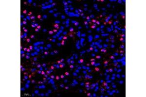 Immunofluorescence of paraffin embedded mouse kidney using Adenosine kinase (ABIN7072953) at dilution of 1: 300 (400x lens)