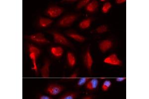 Immunofluorescence analysis of U2OS cells using PPARD Polyclonal Antibody (PPARD antibody)