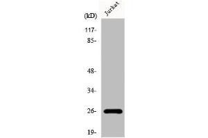 Western Blot analysis of Jurkat cells using Flt3-L Polyclonal Antibody (FLT3LG antibody  (C-Term))