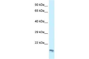 WB Suggested Anti-Sec11c Antibody Titration: 1. (SEC11C antibody  (C-Term))