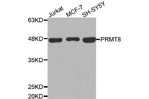 Western blot analysis of extracts of various cell lines, using PRMT8 antibody.