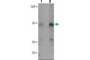 Western blot analysis of KREMEN2 in HeLa cell lysate with KREMEN2 polyclonal antibody  at (lane 1) 1 and (lane 2) 2 ug/mL.