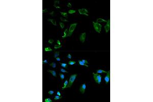 Immunofluorescence analysis of HeLa cells using NEK8 antibody (ABIN5970372). (NEK8 antibody)