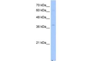 Western Blotting (WB) image for anti-NAD(P) Dependent Steroid Dehydrogenase-Like (NSDHL) antibody (ABIN2463049)