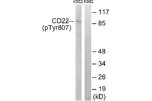 Western blot analysis of extracts from K562 cells, treated with Na3VO4 (0. (CD22 antibody  (pTyr807))