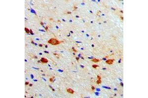 Immunohistochemical analysis of PKA C beta staining in human brain formalin fixed paraffin embedded tissue section. (PRKACB antibody  (C-Term))