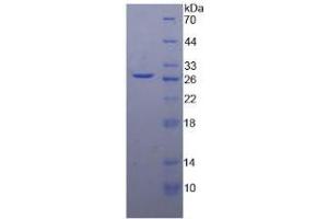 SDS-PAGE analysis of Human DGAT1 Protein. (DGAT1 Protein)