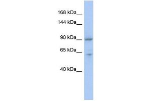 WB Suggested Anti-MLXIP Antibody Titration:  0. (MLXIP antibody  (Middle Region))