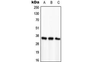 Western blot analysis of PCNA expression in HeLa (A), SP2/0 (B), H9C2 (C) whole cell lysates. (PCNA antibody  (Center))