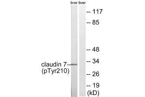 Western Blotting (WB) image for anti-Claudin 7 (CLDN7) (pTyr210) antibody (ABIN1847758) (Claudin 7 antibody  (pTyr210))