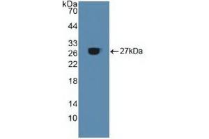 Western blot analysis of recombinant Human ACO1. (Aconitase 1 antibody  (AA 251-443))