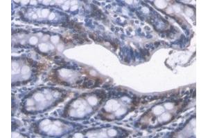 Detection of CBR1 in Mouse Colon Tissue using Polyclonal Antibody to Carbonyl Reductase 1 (CBR1) (CBR1 antibody  (AA 66-271))
