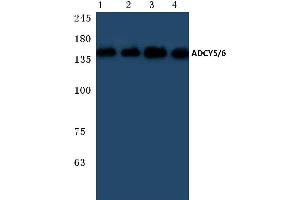 Western blot (WB) analysis of ADCY 5/6 antibody at 1/500 dilution (ADCY5 antibody)