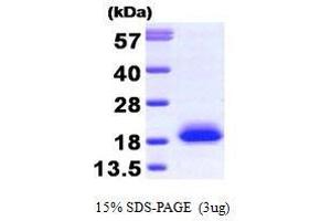 Figure annotation denotes ug of protein loaded and % gel used. (VSNL1 Protein (AA 1-191))
