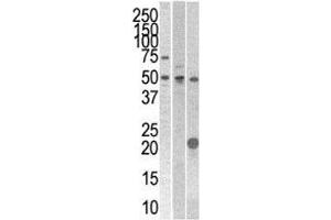 STYK1 antibody western blot analysis with 293, CEM, and mouse kidney cell line/tissue lysate
