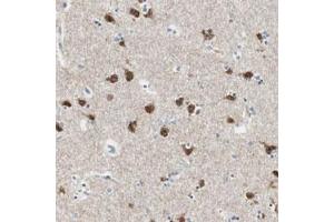 Immunohistochemical staining (Formalin-fixed paraffin-embedded sections) of human lateral ventricle with DLG4 polyclonal antibody  shows strong nuclear and cytoplasmic positivity in neuronal cells at 1:200-1:500 dilution. (DLG4 antibody)