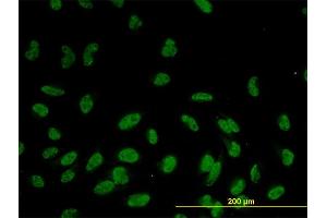 Immunofluorescence of monoclonal antibody to RASSF8 on HeLa cell. (RASSF8 antibody  (AA 40-137))