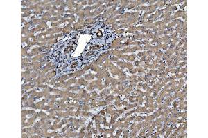 IHC analysis of PDIA6 using anti-PDIA6 antibody (ABIN7600553). (PDIA6 antibody  (AA 20-440))