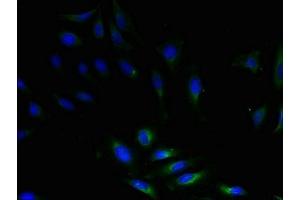 Immunofluorescent analysis of Hela cells using ABIN7149863 at dilution of 1:100 and Alexa Fluor 488-congugated AffiniPure Goat Anti-Rabbit IgG(H+L) (SAT1 antibody  (AA 5-171))